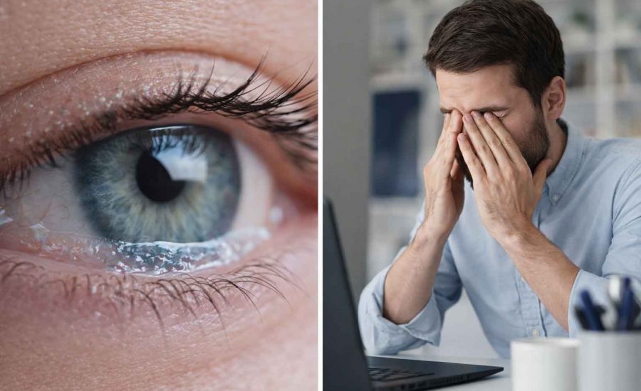 Tränenfilm gestört? Ursachen für trockene oder tränende Augen und Tipps zur Unterstützung – Beratung bei Optik Homann in Rheydt.