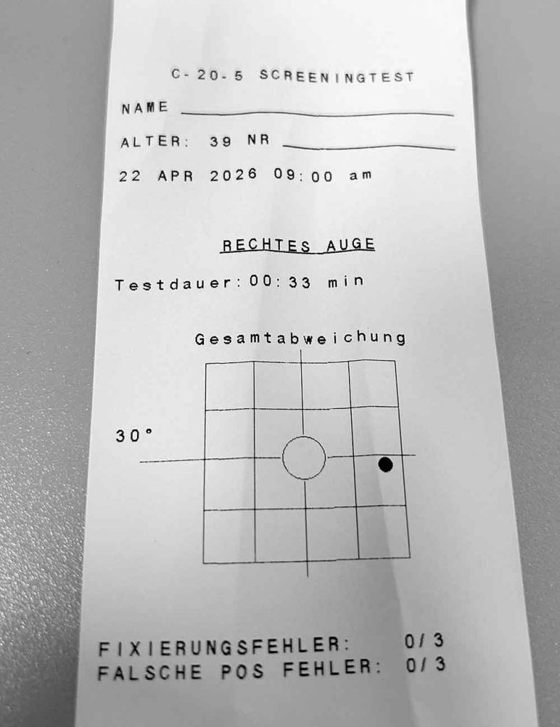 Ausdruck einer Gesichtsfeldmessung mit Raster und markierter Auffälligkeit im rechten Auge